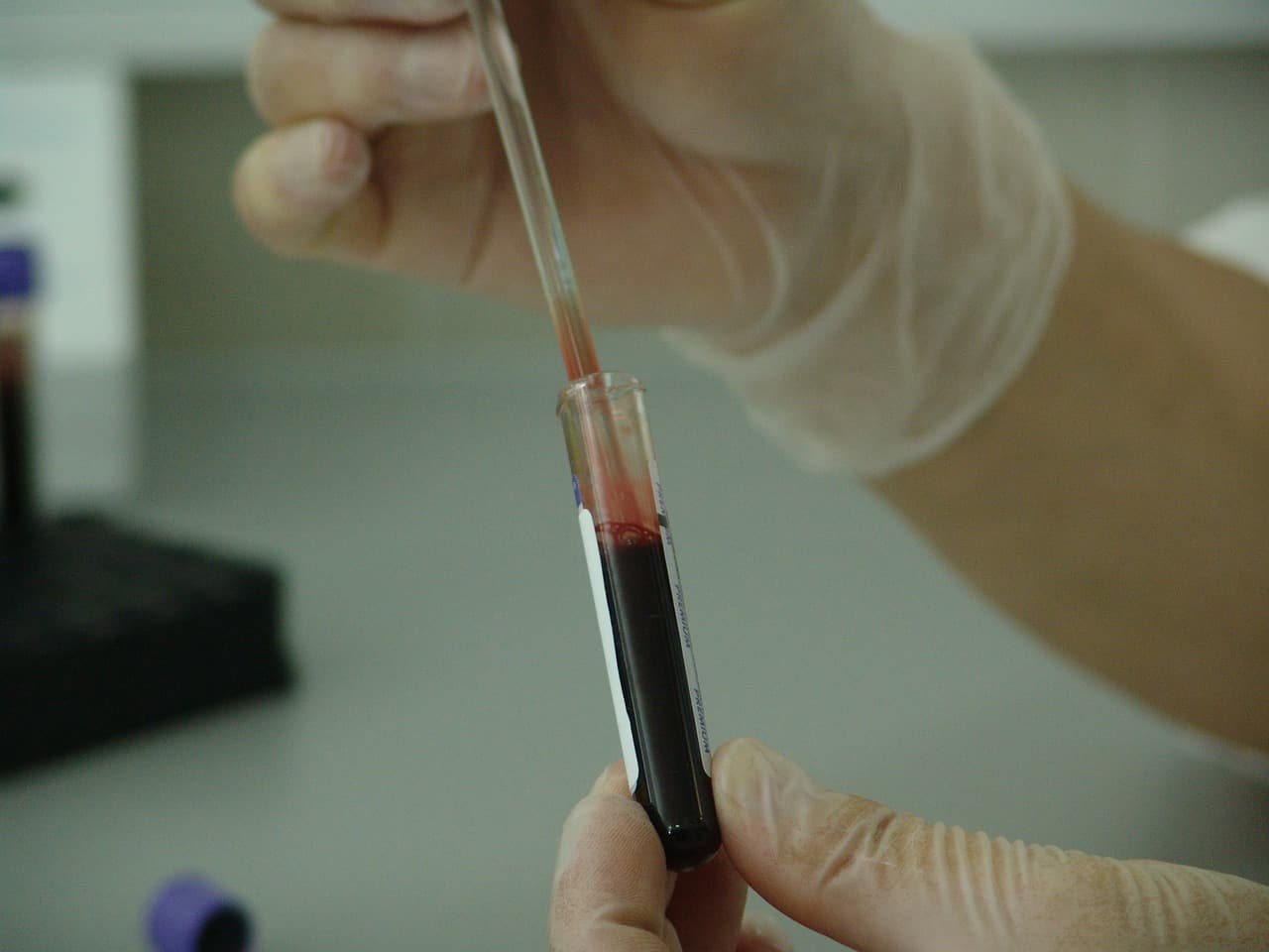 ESR blood test at home- is it possible?