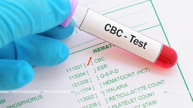 An Ultimate CBC Test Cheat Sheet You Should Check