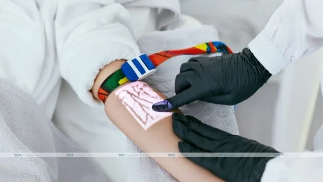 Is Vein Scanning Accurate?