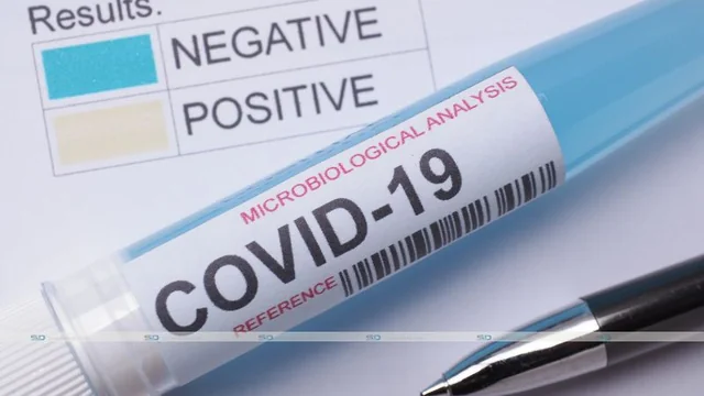 When Should I Do a COVID Test in Orlando