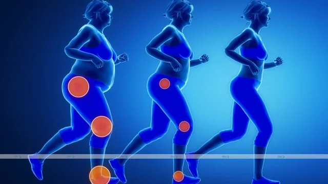 Common Joint Problems and How to Manage Them