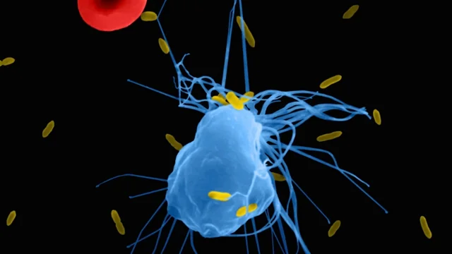 Impetigo Epidemic: Unraveling the Main Cause Behind the Outbreaks!