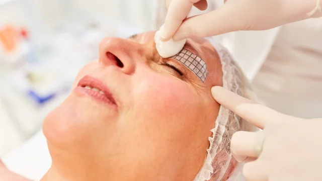 Age-Defying Hacks: How to Tighten Eyelid Skin Without Surgical Risks!