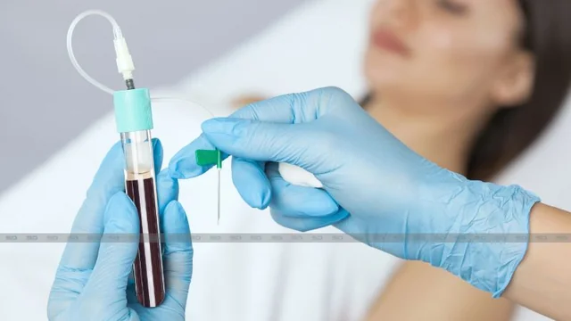 Discover the Power of Neogen Plasma Therapy