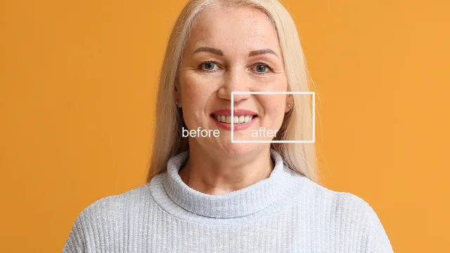 The Mommy Makeover Debate: Is This Surgery the Game-Changer You Need?