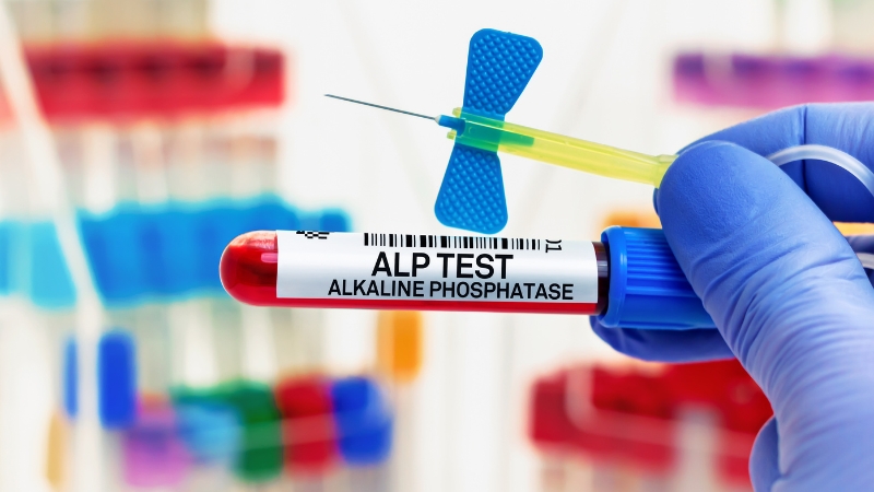 Alkaline Phosphatase